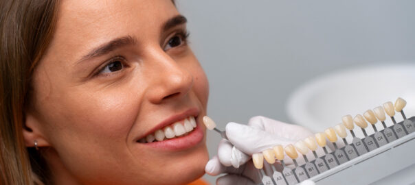 mulher sorrindo e escolhendo a cor do seu clareamento dental